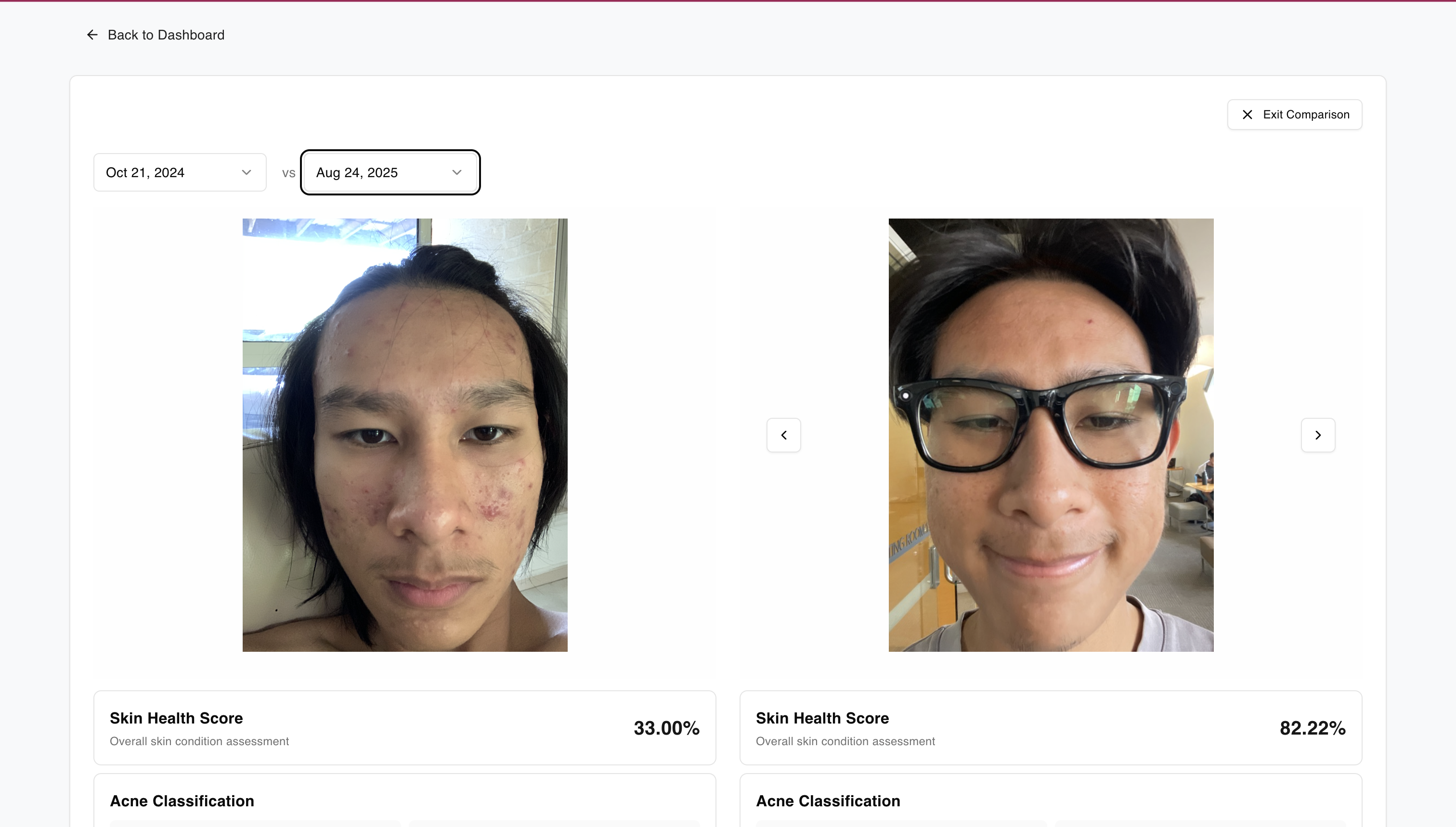 Clariti Dashboard - Skin Health Comparison