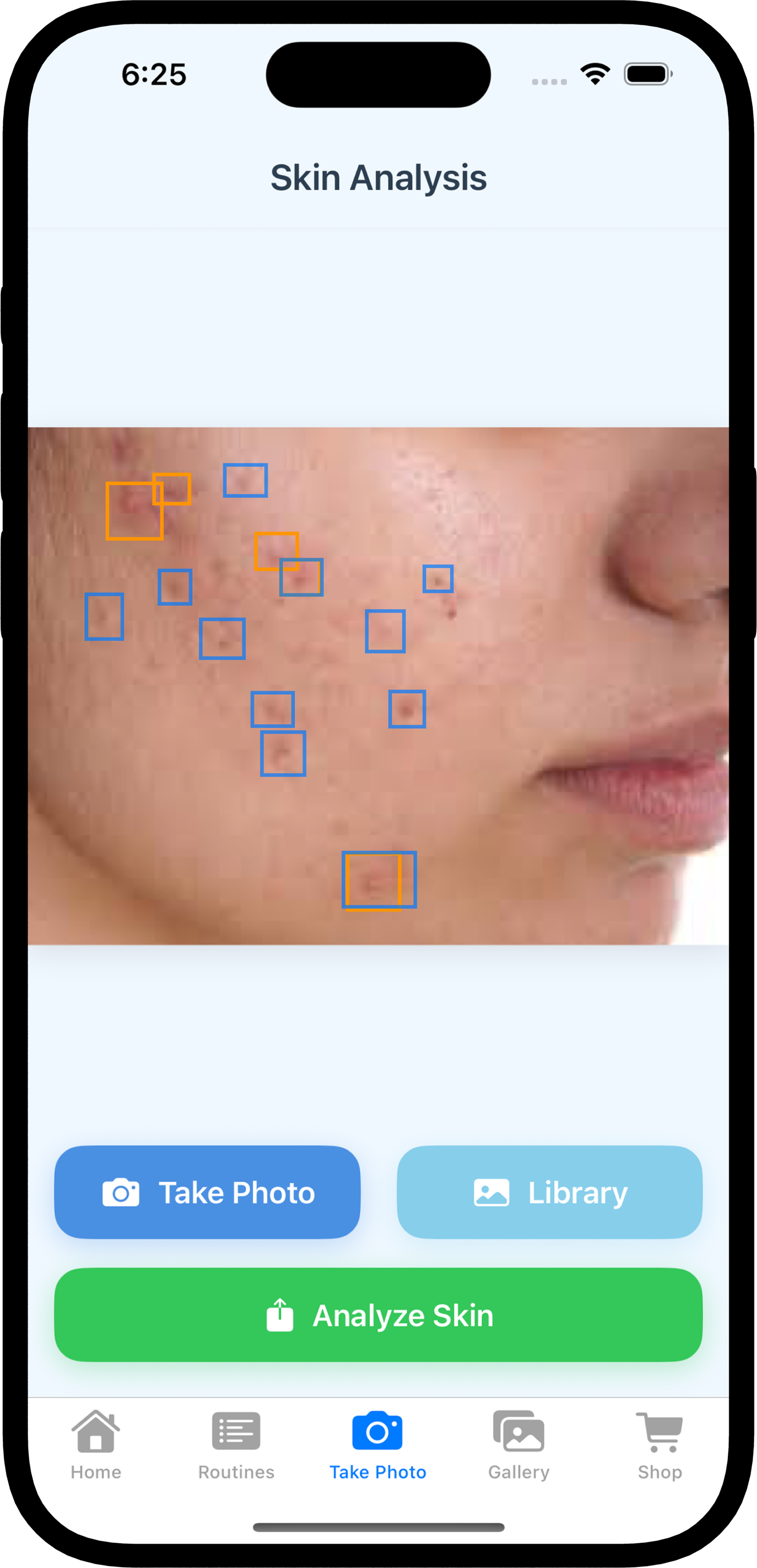 Clariti App - Skin Analysis